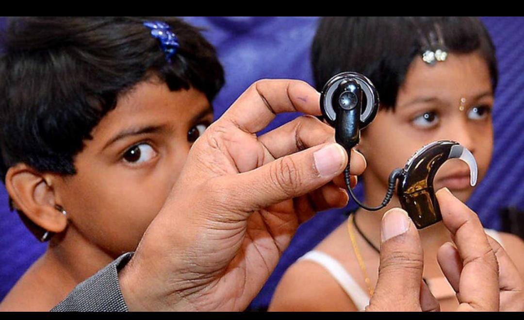 Good news: उर्सला में बच्चों के लिये शुरू होगा कॉक्लियर इम्प्लांट